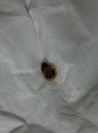 عکس حشره کنه