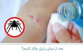 بعد از نیش رتیل چکار کنیم؟